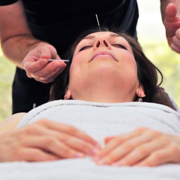 Facial Acupuncture