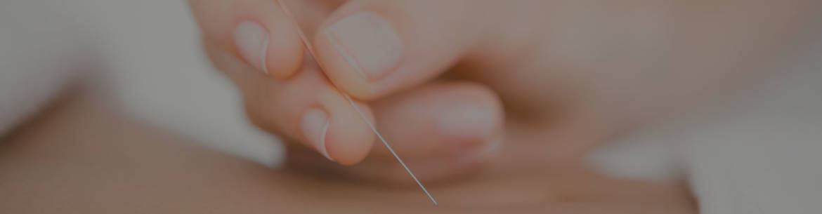 Acupuncture-Wellness.jpg