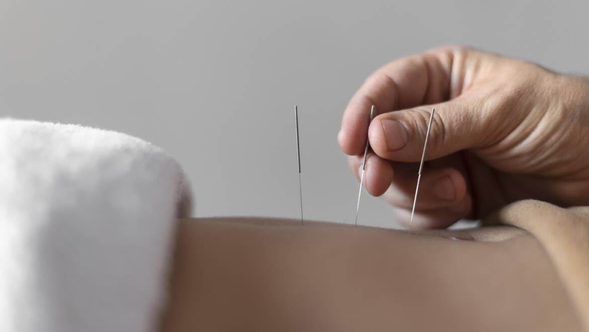 Menopause Relief in Houston: How Acupuncture & Chinese Herbs Offer Natural Solutions