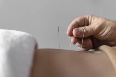 Menopause Relief in Houston: How Acupuncture & Chinese Herbs Offer Natural Solutions